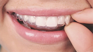 Removable Design