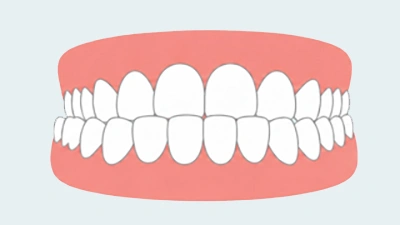 Crossbite